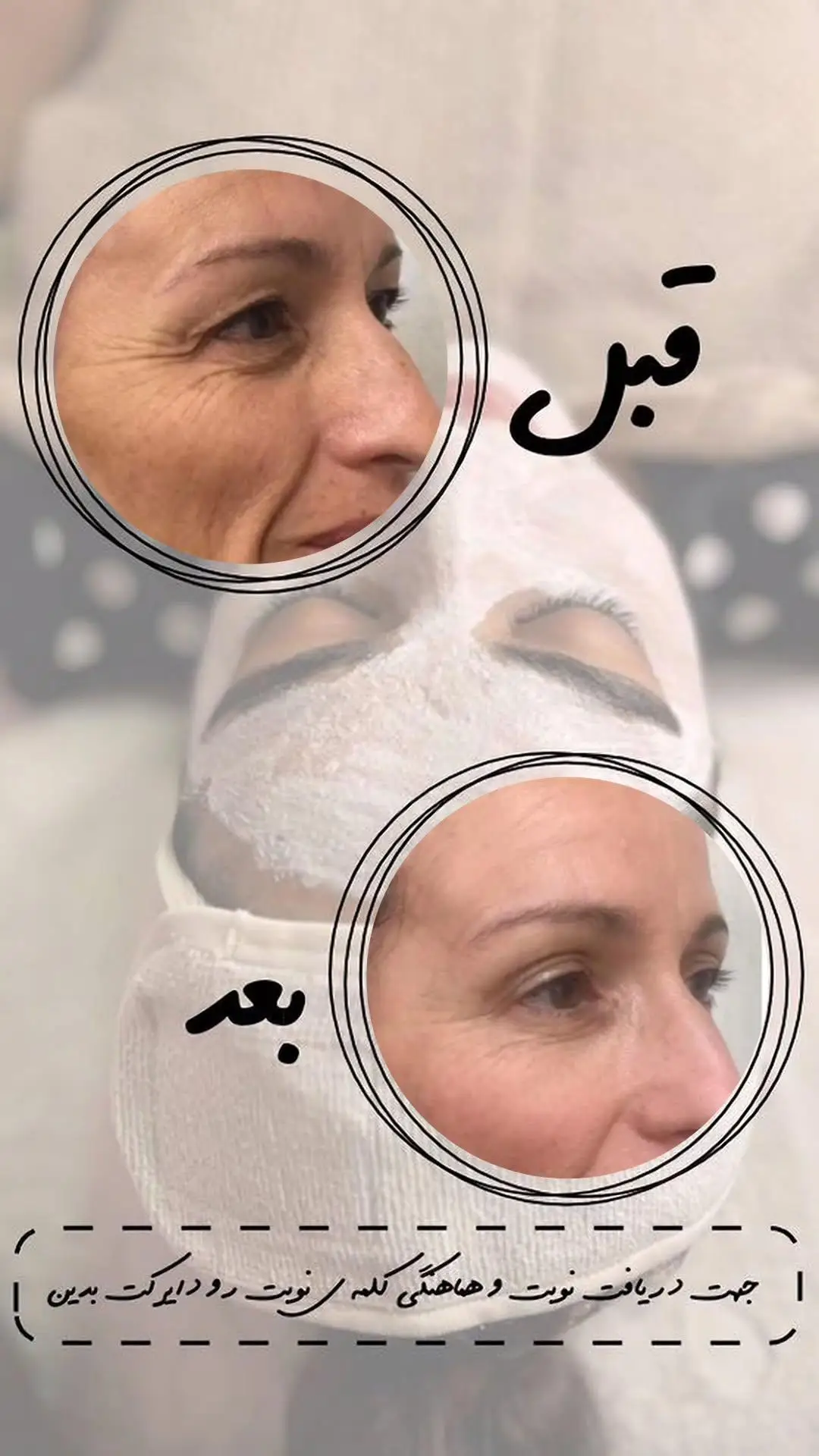 کرم ضد چین و چروک بیوممتیک — تصویر 4
