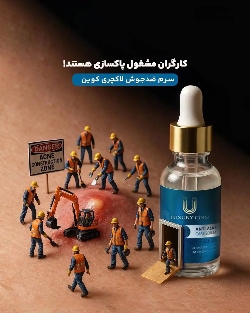 سرم ضد جوش لاکچری کوین — تصویر محصول