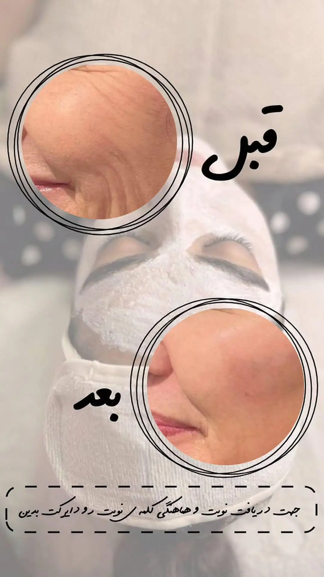 کرم ضد چین و چروک بیوممتیک — تصویر 2