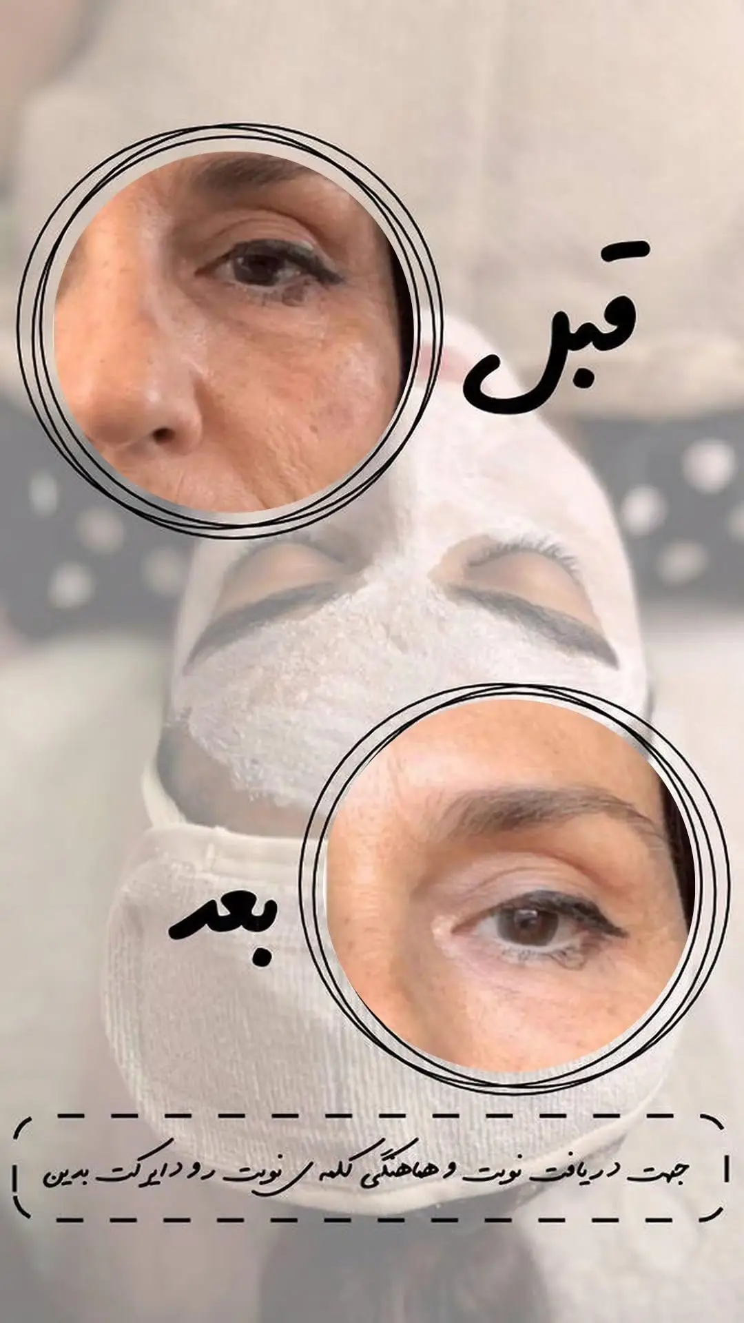 کرم ضد چین و چروک بیوممتیک — تصویر 5