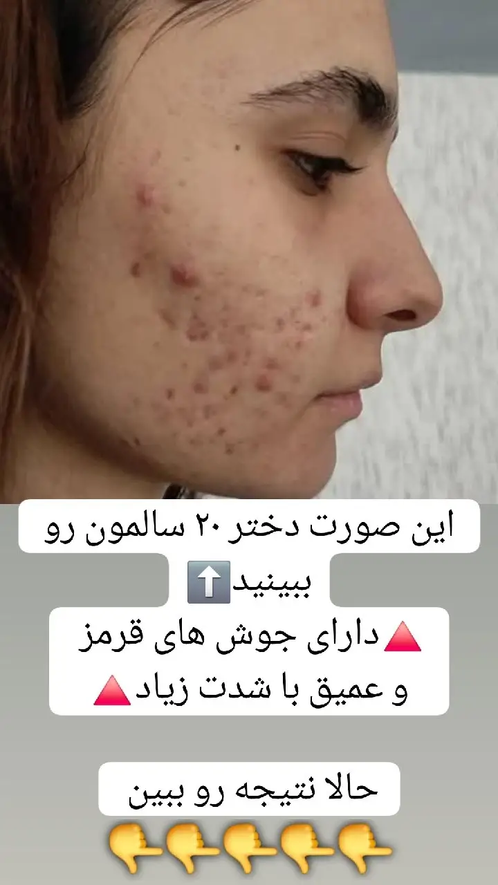 دوره ضد جوش اقتصادی — تصویر 5