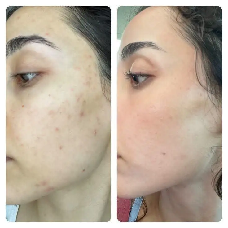 دوره ضد جوش اقتصادی — تصویر 3