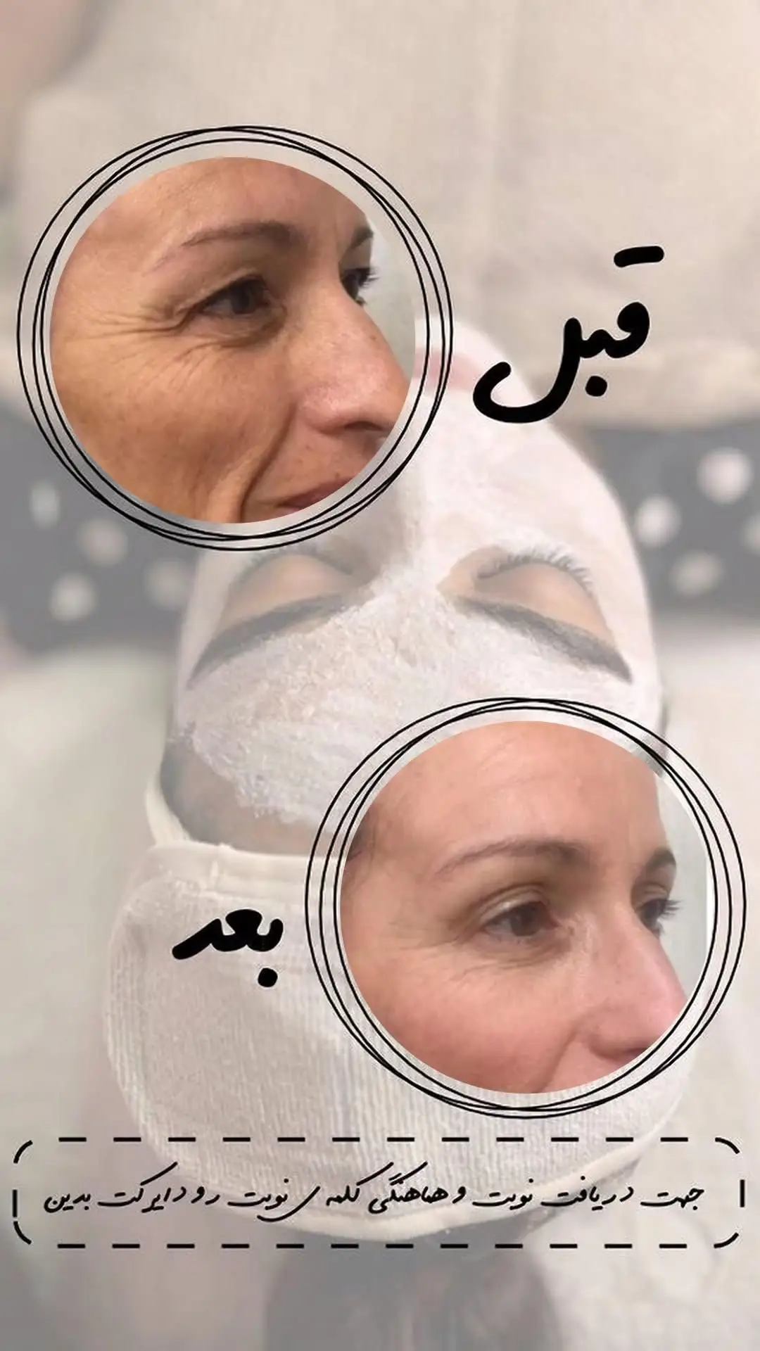 کرم ضد چین و چروک گاتیو — تصویر 3